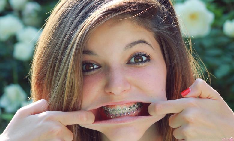 تاثیر ارتودنسی بر فرم لب